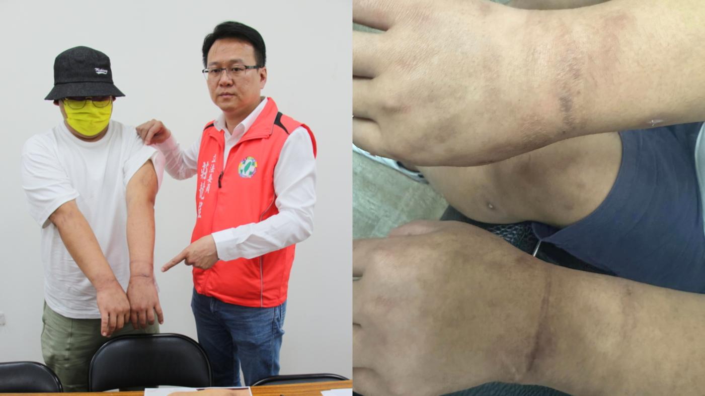 台中餐廳業者哈利（左圖左）去年6月被詐騙集團騙到柬埔寨淪為豬仔，被囚禁毆打（右圖），12日他在民進黨立委莊競程（左圖右）陪同下舉行記者會述說被騙過程。中央社、GASO提供